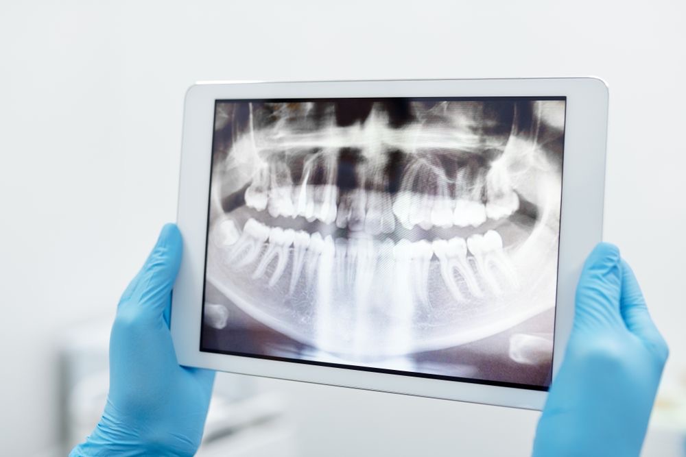 X-rays and 3D scans at the chair